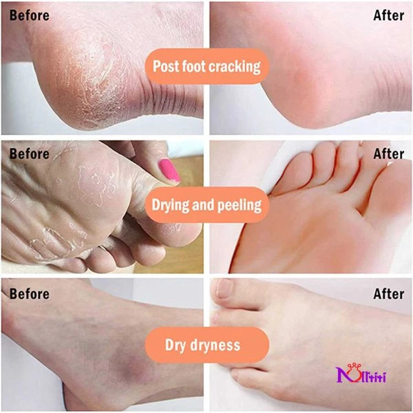 اسپری ترک پا